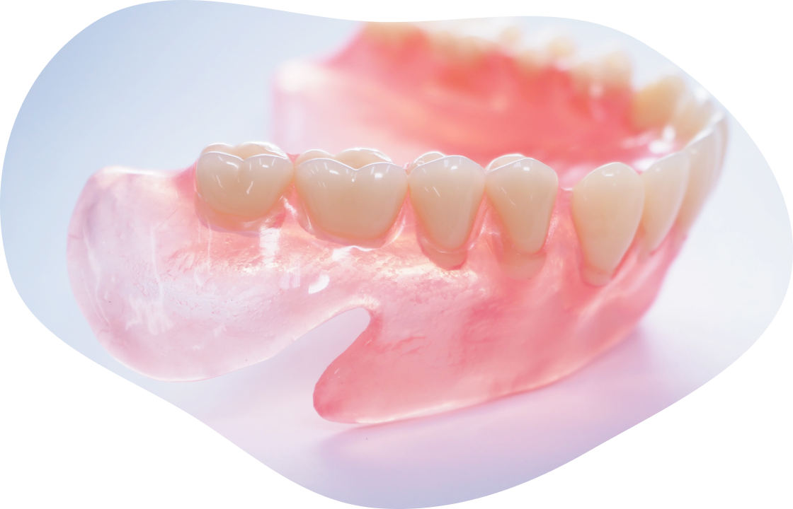 精密な入れ歯